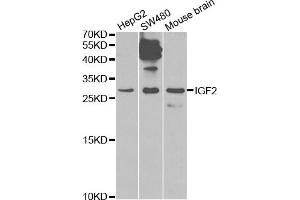 Western blot analysis of extracts of various cell lines, using IGF2 antibody (ABIN1873163) at 1:1000 dilution. (IGF2 antibody)