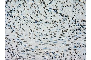 Image no. 1 for anti-Premelanosome Protein (PMEL) antibody (ABIN1500300) (Melanoma gp100 antibody)