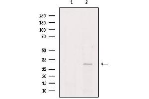 Western blot analysis of extracts from Hela, using NKX62 Antibody. (NKX6-2 antibody)