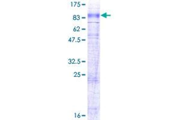 SLC6A7 Protein (AA 1-636) (GST tag)