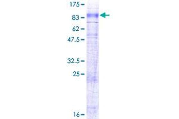 SLC6A7 Protein (AA 1-636) (GST tag)