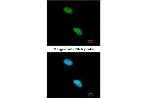 ICC/IF Image Immunofluorescence analysis of paraformaldehyde-fixed HeLa, using CBP80 , antibody at 1:200 dilution. (NCBP1 antibody  (N-Term))