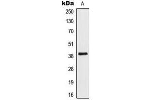 Western blot analysis of AIM2 expression in Jurkat (A) whole cell lysates. (AIM2 antibody  (Center))