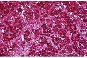 Human Adrenal: Formalin-Fixed, Parraffin-Embedded (FFPE) (Ferredoxin Reductase antibody)