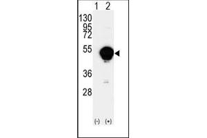 Western blot analysis of CYP20A1(arrow) using rabbit polyclonal CYP20A1 Antibody (CYP20A1 antibody  (C-Term))