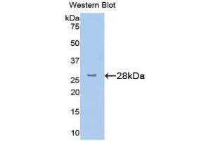 Detection of Recombinant TMEM173, Human using Polyclonal Antibody to Transmembrane Protein 173 (TMEM173) (STING/TMEM173 antibody  (AA 159-373))