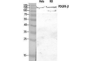 Western Blotting (WB) image for anti-Platelet Derived Growth Factor Receptor beta (PDGFRB) (Thr215) antibody (ABIN3180254) (PDGFRB antibody  (Thr215))