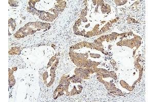 IHC analysis of OLMF4 using anti-OLMF4 antibody (ABIN6719350). (Olfactomedin 4 antibody  (AA 91-510))
