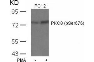 Image no. 4 for anti-Protein Kinase C, theta (PRKCQ) (pSer676) antibody (ABIN197070)
