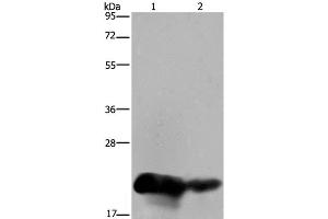 Western Blot analysis of Human placenta and breast infiltRative duct tissue using CSH1 Polyclonal Antibody at dilution of 1:200 (CSH1 antibody)