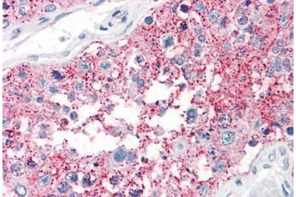 SRPX2 antibody  (C-Term)