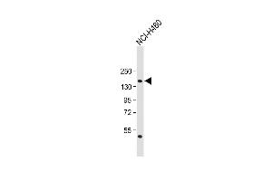 Anti-NPC1 Antibody (Center) at 1:1000 dilution + NCI- whole cell lysate Lysates/proteins at 20 μg per lane. (NPC1 antibody  (AA 591-620))