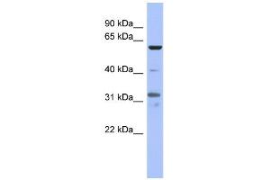WB Suggested Anti-PAX8 Antibody Titration:  0. (PAX8 antibody  (Middle Region))