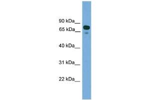 WB Suggested Anti-ZNF599 Antibody Titration: 0.