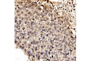 IHC analysis of IFI16 using anti-IFI16 antibody (ABIN7600374). (IFI16 antibody  (AA 183-743))