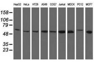 Image no. 14 for anti-5'-Nucleotidase Domain Containing 1 (NT5DC1) antibody (ABIN1499838)