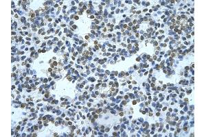 Rabbit Anti-ZMYND11 Antibody       Paraffin Embedded Tissue:  Human alveolar cell   Cellular Data:  Epithelial cells of renal tubule  Antibody Concentration:   4.