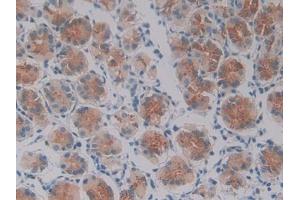 DAB staining on IHC-P; Samples: Human Stomach Tissue (Oncostatin M antibody  (AA 26-220))