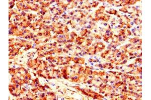Immunohistochemistry of paraffin-embedded human pancreatic tissue using ABIN7149038 at dilution of 1:100 (CARS antibody  (AA 201-500))