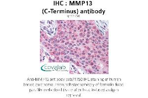 Image no. 1 for anti-Matrix Metallopeptidase 13 (Collagenase 3) (MMP13) (C-Term) antibody (ABIN1737010) (MMP13 antibody  (C-Term))