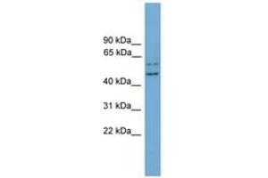 Image no. 1 for anti-RAB11 Family Interacting Protein 2 (Class I) (RAB11FIP2) (AA 71-120) antibody (ABIN6745082) (RAB11FIP2 antibody  (AA 71-120))