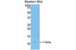 Western Blotting (WB) image for anti-CD3d Molecule, delta (CD3-TCR Complex) (CD3D) (AA 22-106) antibody (ABIN1175145)
