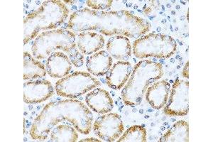 Immunohistochemistry of paraffin-embedded Mouse kidney using INHBC Polyclonal Antibody at dilution of 1:100 (40x lens). (INHBC antibody)