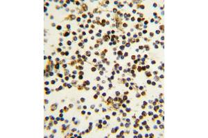 Immunohistochemistry (Paraffin-embedded Sections) (IHC (p)) image for anti-Nucleophosmin (Nucleolar phosphoprotein B23, Numatrin) (NPM1) (AA 7-33), (N-Term) antibody (ABIN389342)