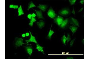 Immunofluorescence (IF) image for anti-Protein Phosphatase, Mg2+/Mn2+ Dependent, 1B (PPM1B) (AA 1-192) antibody (ABIN562341)