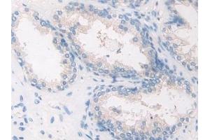 Immunohistochemistry (IHC) image for anti-Calcineurin (CAN) (AA 7-301) antibody (ABIN7433471)