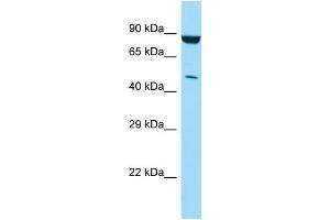 Western Blotting (WB) image for anti-Phosphatidylinositol-5-Phosphate 4-Kinase, Type II, gamma (PIP4K2C) (C-Term) antibody (ABIN2790338)
