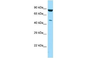 WB Suggested Anti-PIP4K2C Antibody Titration: 1. (PIP4K2C antibody  (C-Term))