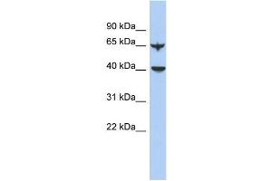 Human Lung; WB Suggested Anti-APOBEC4 Antibody Titration: 0. (APOBEC4 antibody  (N-Term))