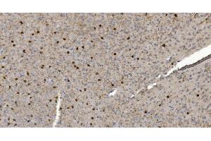 IHC analysis of Alpha B Crystallin/CRYAB using anti-Alpha B Crystallin/CRYAB antibody (ABIN7601209). (CRYAB antibody  (AA 30-151))