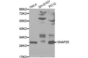 Western blot analysis of extracts of various cell lines, using SNAP25 antibody (ABIN5970374) at 1/1000 dilution. (SNAP25 antibody)