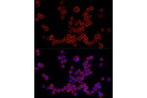 Immunofluorescence analysis of R. (NLRP3 antibody  (C-Term))