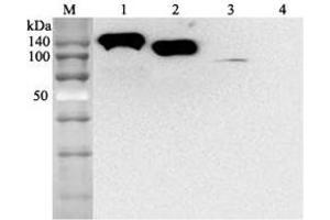 Western blot analysis using anti-ACE2 (human), mAb (AC384)  at 1:2'000 dilution. (ACE2 antibody)