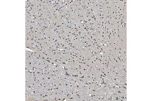 IHC analysis of SNRNP27 using anti-SNRNP27 antibody (ABIN7599614). (SNRNP27 antibody  (AA 100-155))