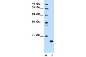 WB Suggested Anti-C8B Antibody Titration:  0. (C8B antibody  (C-Term))