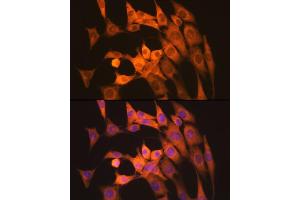 Immunofluorescence analysis of NIH-3T3 cells using Calpain 1 Rabbit mAb (ABIN7266033) at dilution of 1:100 (40x lens). (CAPNL1 antibody)