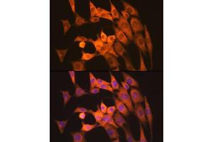 Immunofluorescence analysis of NIH-3T3 cells using Calpain 1 Rabbit mAb (ABIN7266033) at dilution of 1:100 (40x lens).