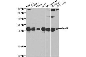 Western blot analysis of extracts of various cell lines, using GAMT antibody. (GAMT antibody  (AA 1-236))