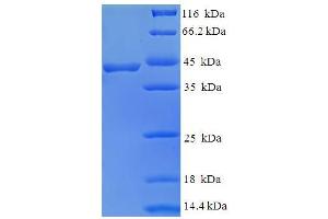 SDS-PAGE (SDS) image for BEN Domain Containing 3 (BEND3) (AA 328-461), (partial) protein (GST tag) (ABIN5711413)