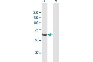 Western Blotting (WB) image for anti-Protein Phosphatase 2, Regulatory Subunit A, beta (PPP2R1B) (AA 1-601) antibody (ABIN519116)