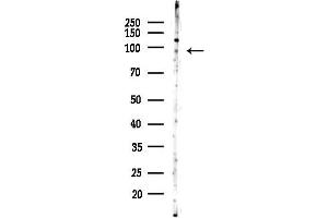 anti-Terminal Uridylyl Transferase 1, U6 SnRNA-Specific (TUT1) (N-Term) antibody