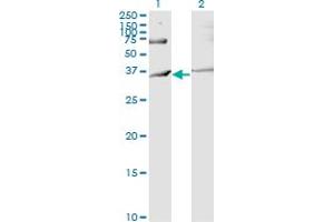 Western Blot analysis of RNF144B expression in transfected 293T cell line by IBRDC2 monoclonal antibody (M02), clone 4F1. (RNF144B antibody  (AA 1-100))