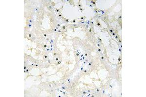 Immunohistochemical analysis of NR2F2 staining in human kidney formalin fixed paraffin embedded tissue section.