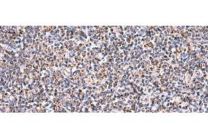 Immunohistochemistry of paraffin-embedded Human tonsil tissue using HSF2BP Polyclonal Antibody at dilution of 1:30(x200)