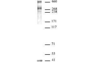 SMRT / NCoR2 antibody (pAb) tested by Western blot. (NCOR2 antibody  (N-Term))