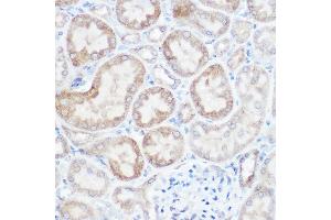 Immunohistochemistry of paraffin-embedded mouse kidney using [KO Validated] NDUFB4 Rabbit pAb (ABIN6133349, ABIN6144476, ABIN6144477 and ABIN7101430) at dilution of 1:150 (40x lens).
